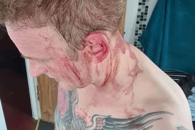 Tomas Ryan was left covered in blood after the bird's attack
