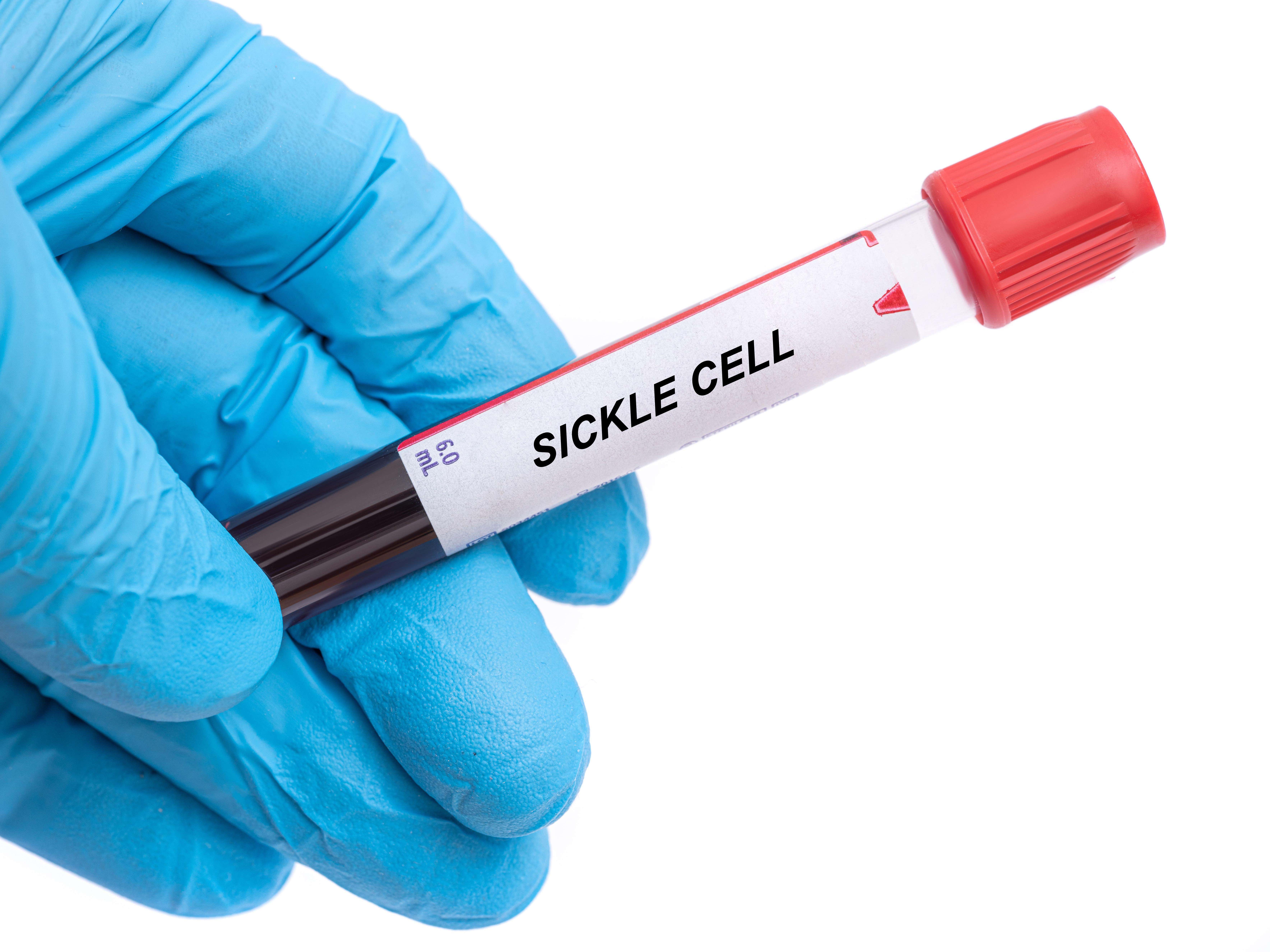 £1.65m gene-editing therapy offers hope of cure for some blood disorder ...