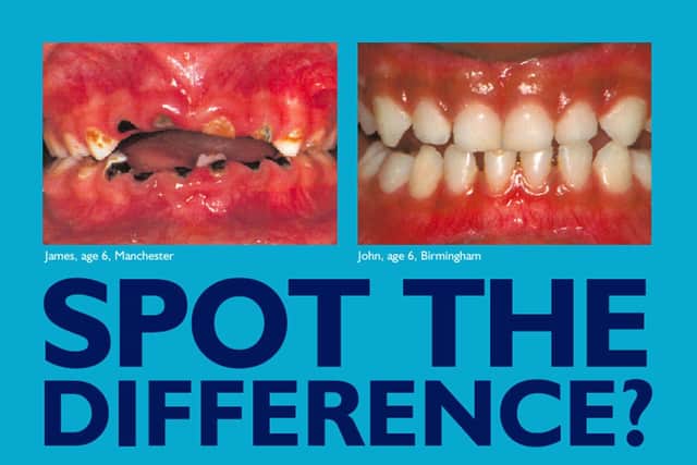 A British Dental Association advert back in 2003 promoting the use of fluoride to help the heath of teeth
