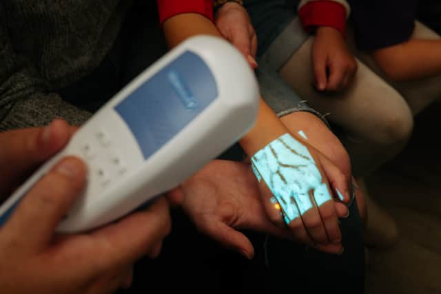 The Veinseight VS5000 machine helps find veins in children