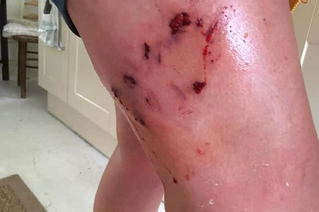 The injured dog walker