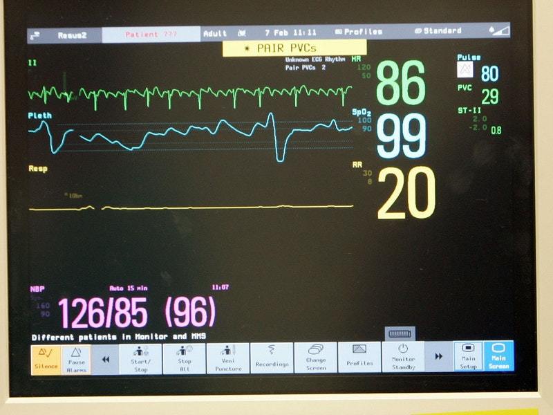 No battery required – ‘symbiotic’ pacemaker powered by heartbeats