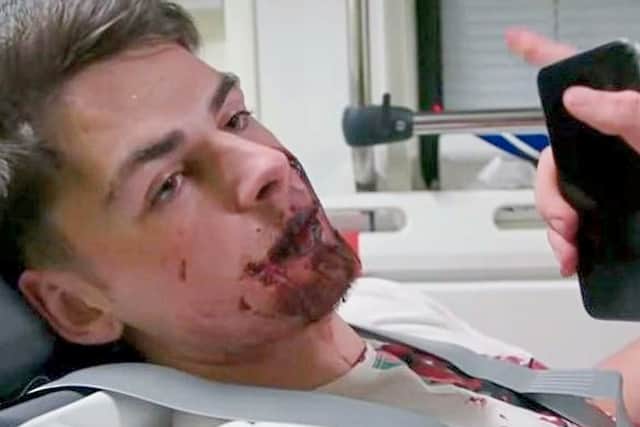 One of the victims of the Buttermarket stabbing, as seen on BBC's Ambulance