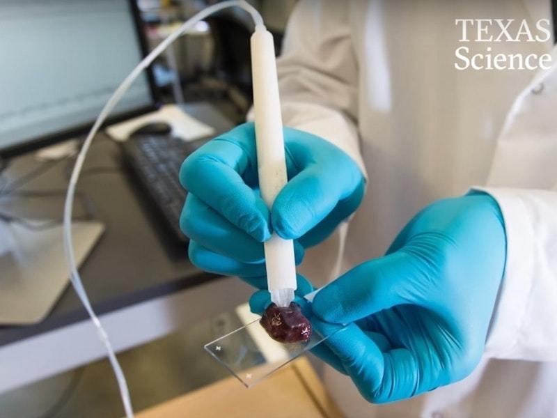 This pen-like device can detect cancer in a matter of seconds