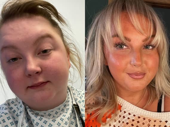 Holly Dyson before and after she gave up alcohol