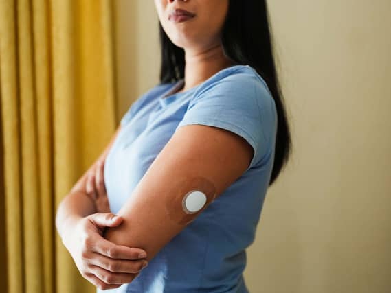 An insulin patch on the arm of a young woman with her arms folded