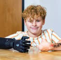 Fin Lawlor has received his new bionic arm in time for school