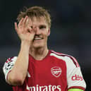 Arsenal's Martin Odegaard holds his fingers in front of his eye