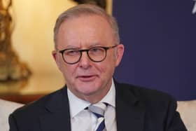 Anthony Albanese