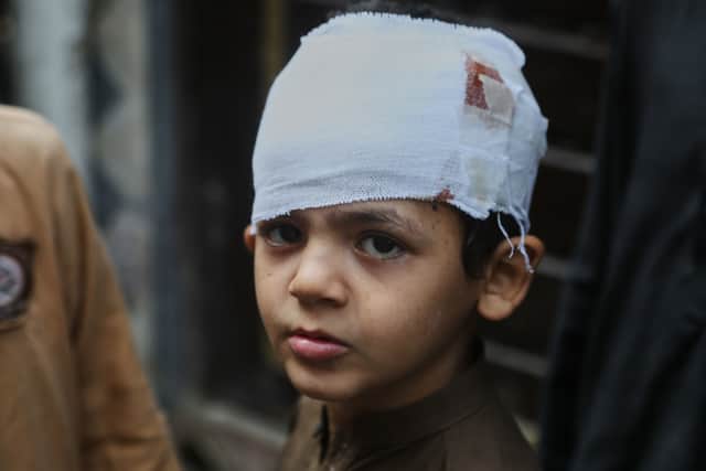 Muhammad Murtaza was injured in Thursday’s roof collapse at a private school (AP)