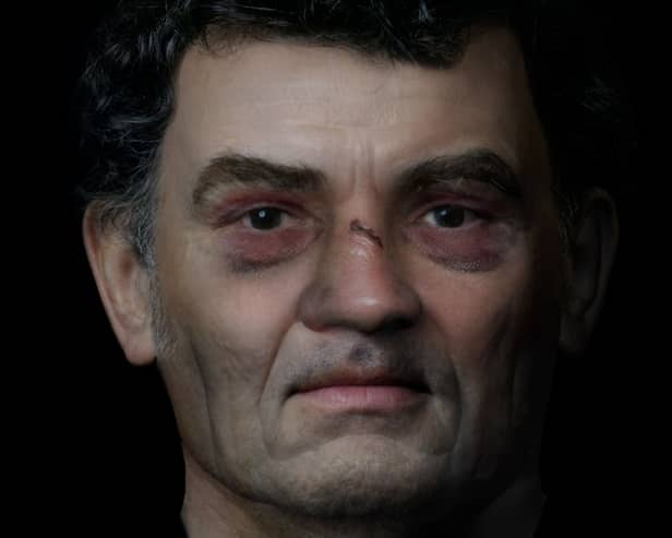 Facial reconstruction of man