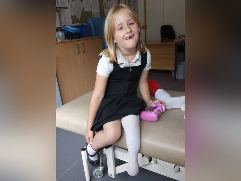 Brave ballerina girl still smiling after rare bone 