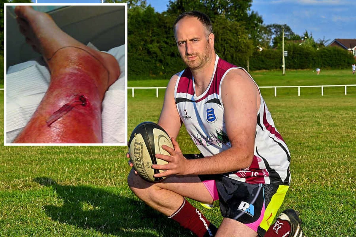 Dog poo on pitch almost cost rugby player his foot
