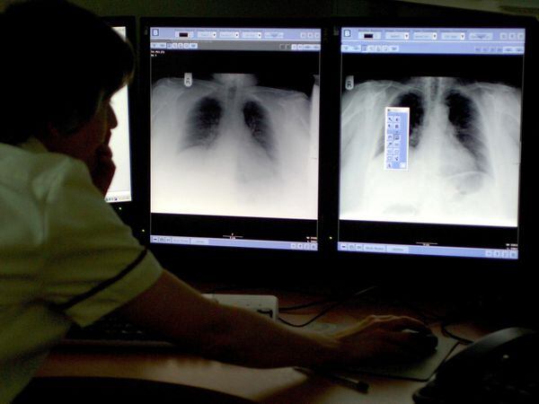 A consultant studying a chest X-ray