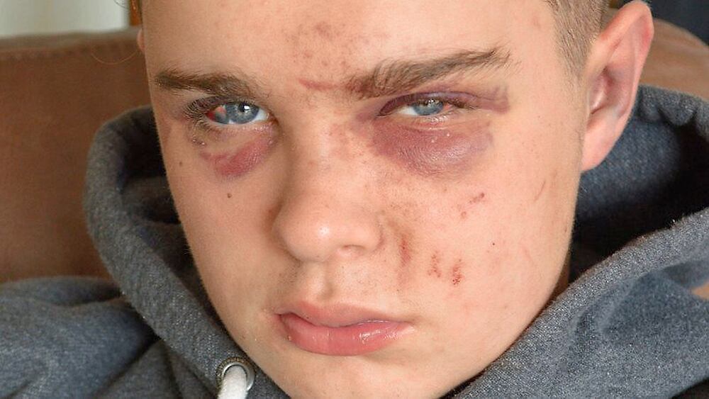 adolescence, Thousands sign petition after paramedic makes plea following attack on teenager