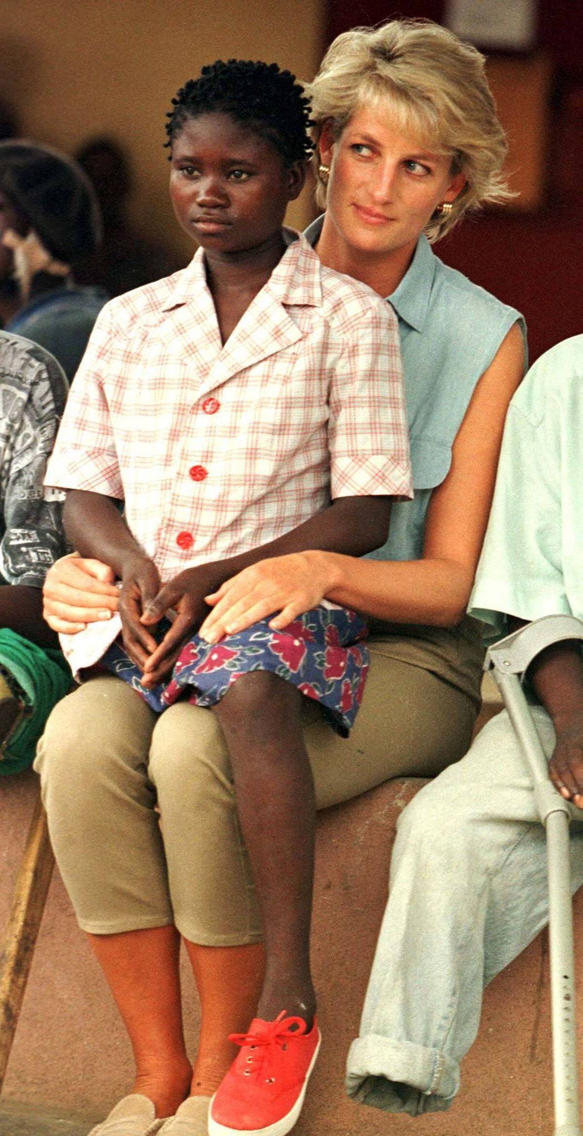 Diana with a child who had lost a leg due to a land-mine injury