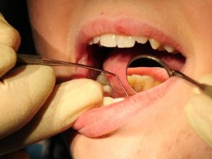 Concern over a rise in DIY dentistry (PA)