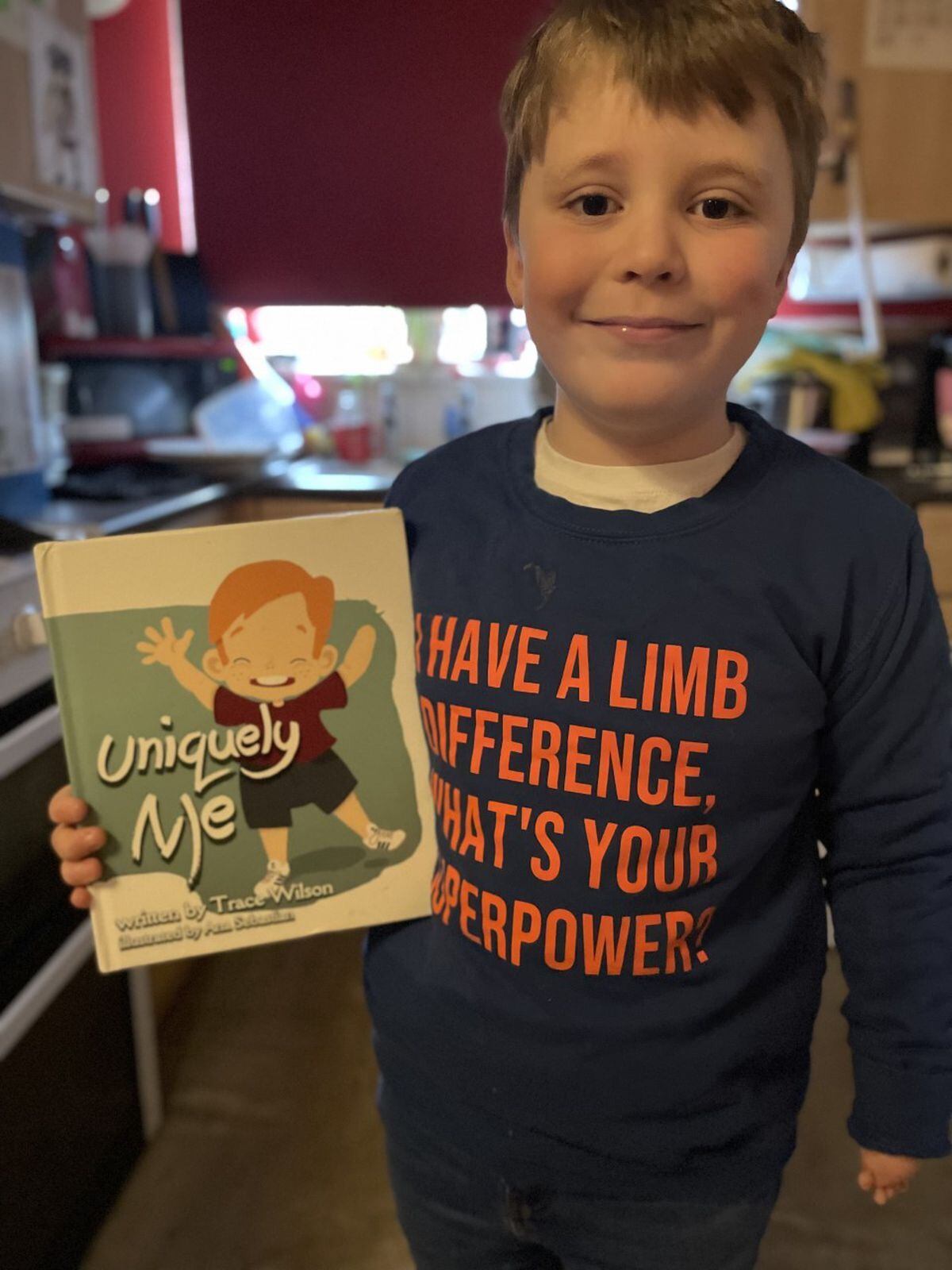 Aston-William, aged, 7, who was born with an upper-limb difference, dressed up as himself for World Book Day to show everyone that it is okay to be different