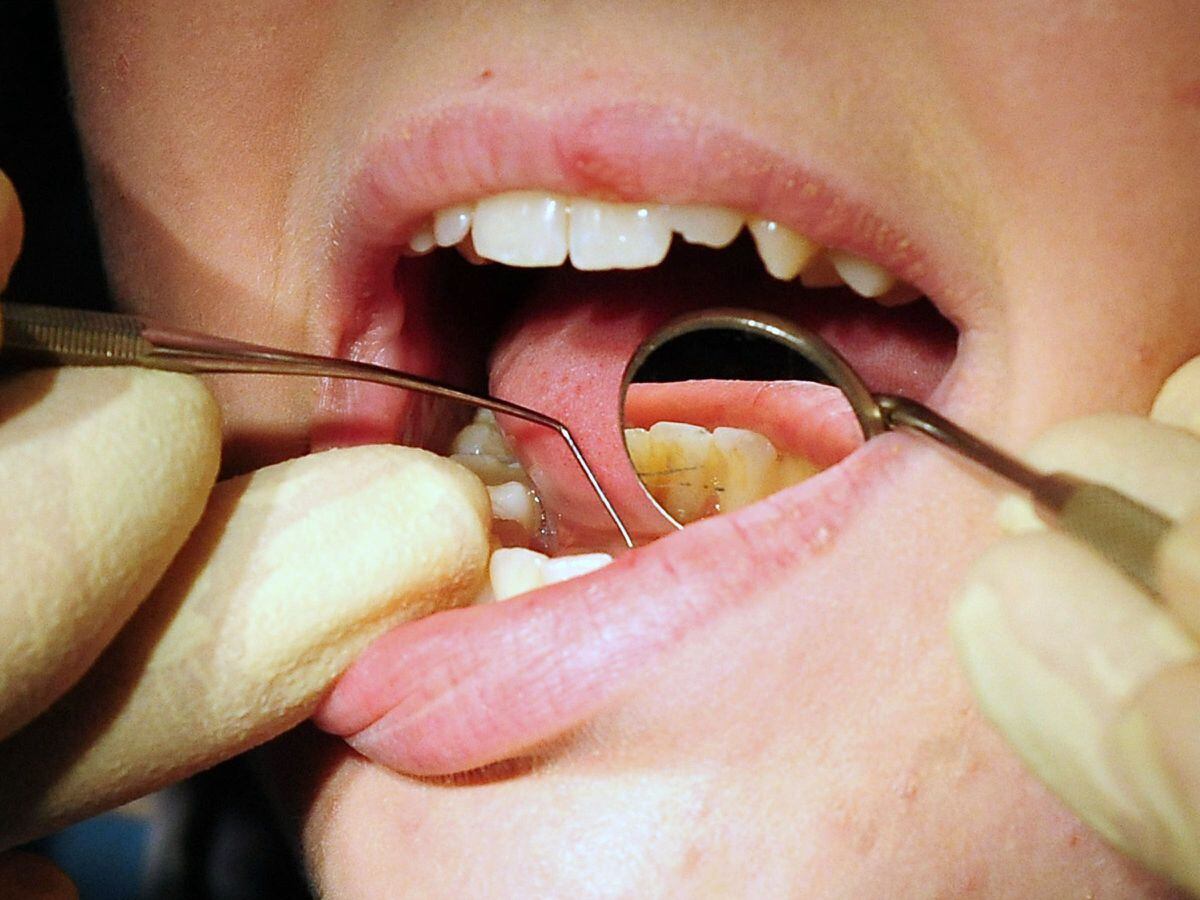 Bupa Dental Care to cut 85 practices