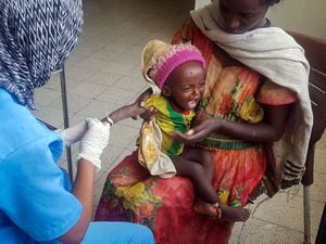 A baby is treated for malnutrition